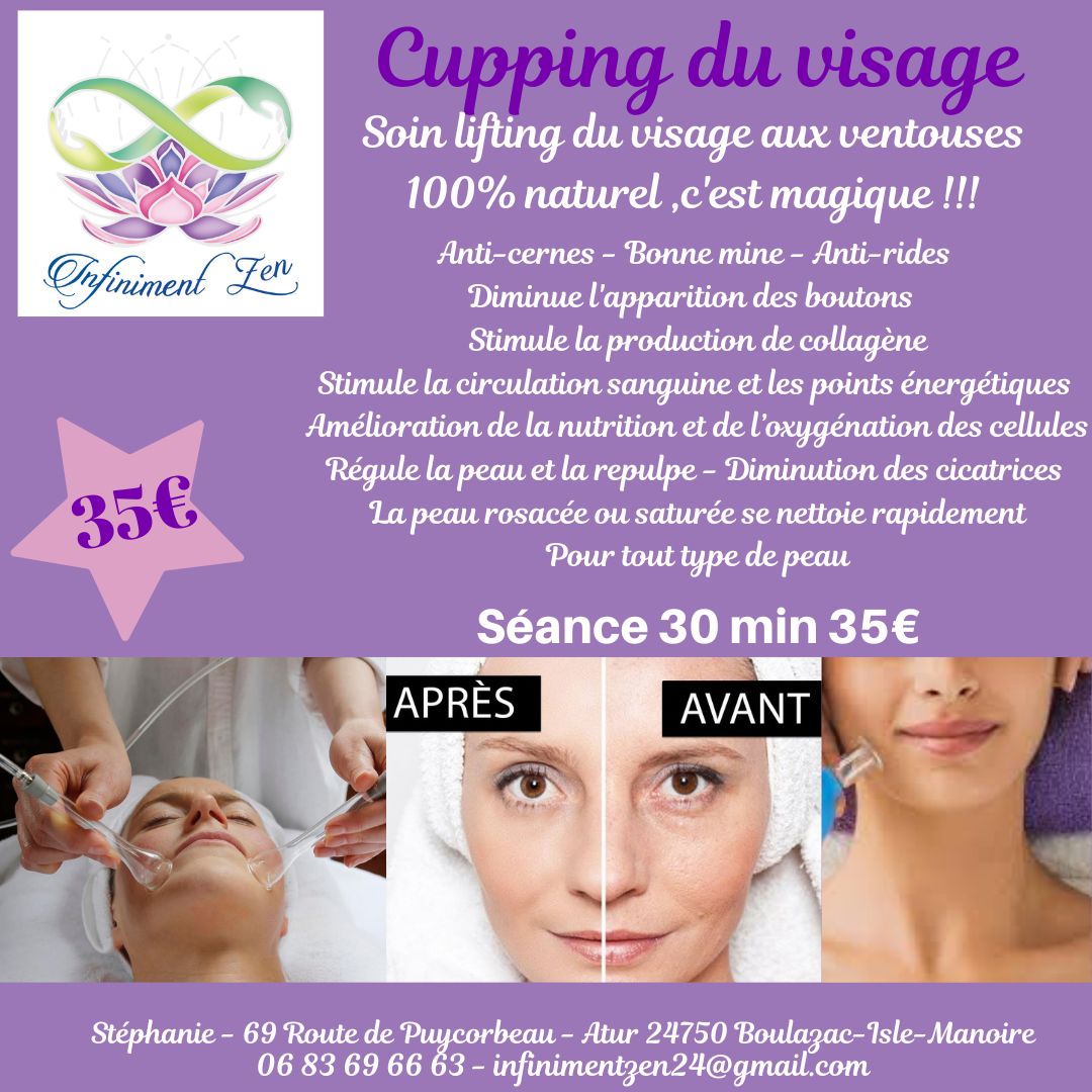 Cupping_du_Visage_Infiniment_Zen_2023 Accueil